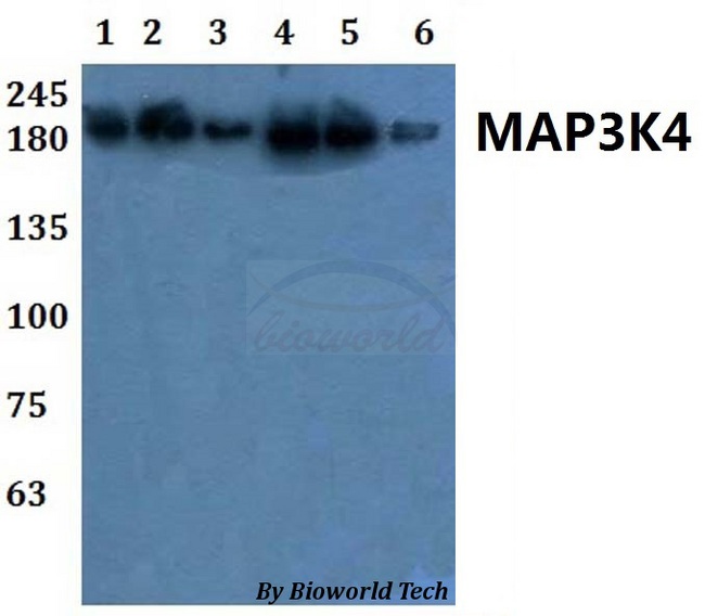 MAP3K4 / MEKK4 Antibody - Western blot of MAP3K4 antibody at 1:500 dilution. Lane 1: A549 whole cell lysate. Lane 2: HEK293T whole cell lysate. Lane 3: PC12 whole cell lysate. Lane 4: SP20 whole cell lysate. Lane 5: H9C2 whole cell lysate. Lane 6: Raw264.7 whole cell lysate.