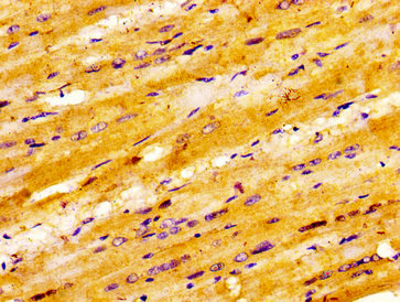 MAP3K4 / MEKK4 Antibody - Immunohistochemistry image at a dilution of 1:100 and staining in paraffin-embedded human heart tissue performed on a Leica BondTM system. After dewaxing and hydration, antigen retrieval was mediated by high pressure in a citrate buffer (pH 6.0) . Section was blocked with 10% normal goat serum 30min at RT. Then primary antibody (1% BSA) was incubated at 4 °C overnight. The primary is detected by a biotinylated secondary antibody and visualized using an HRP conjugated ABC system.