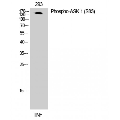 MAP3K5 / ASK1 Antibody - Western blot of Phospho-ASK 1 (S83) antibody