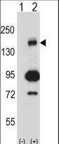 MAP3K5 / ASK1 Antibody - Western blot of Map3k5 (arrow) using rabbit polyclonal Mouse Map3k5 Antibody. 293 cell lysates (2 ug/lane) either nontransfected (Lane 1) or transiently transfected (Lane 2) with the Map3k5 gene.