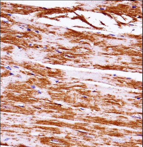 MAP3K5 / ASK1 Antibody - Mouse Map3k5 Antibody immunohistochemistry of formalin-fixed and paraffin-embedded mouse heart tissue followed by peroxidase-conjugated secondary antibody and DAB staining.