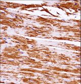 MAP3K5 / ASK1 Antibody - Mouse Map3k5 Antibody immunohistochemistry of formalin-fixed and paraffin-embedded mouse heart tissue followed by peroxidase-conjugated secondary antibody and DAB staining.
