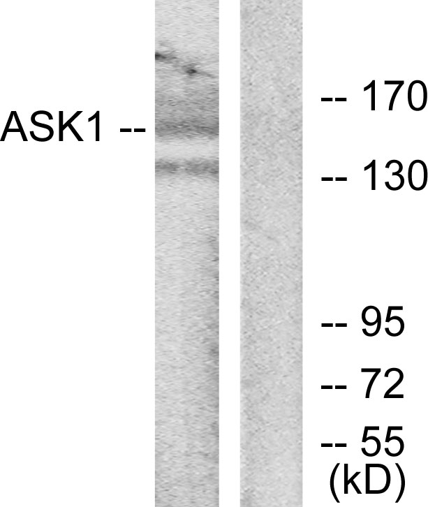 MAP3K5 / ASK1 Antibody - Western blot analysis of lysates from RAW264.7 cells, using ASK1 Antibody. The lane on the right is blocked with the synthesized peptide.