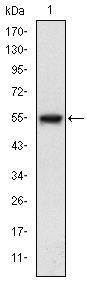 MAP3K5 / ASK1 Antibody - ASK1 Antibody in Western Blot (WB)