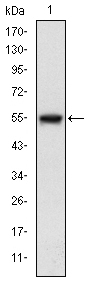 MAP3K5 / ASK1 Antibody - Western blot using MAP3K5 monoclonal antibody against human MAP3K5 (AA: 922-1108) recombinant protein. (Expected MW is 46.5 kDa)