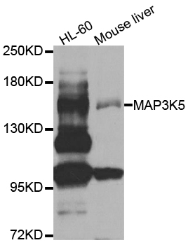 MAP3K5 / ASK1 Antibody - Western blot analysis of extracts of various cell lines, using MAP3K5 antibody at 1:1000 dilution. The secondary antibody used was an HRP Goat Anti-Rabbit IgG (H+L) at 1:10000 dilution. Lysates were loaded 25ug per lane and 3% nonfat dry milk in TBST was used for blocking. An ECL Kit was used for detection and the exposure time was 30s.