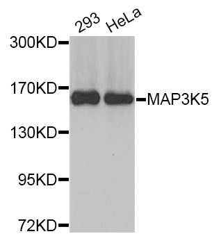 MAP3K5 / ASK1 Antibody - Western blot analysis of extracts of various cell lines.