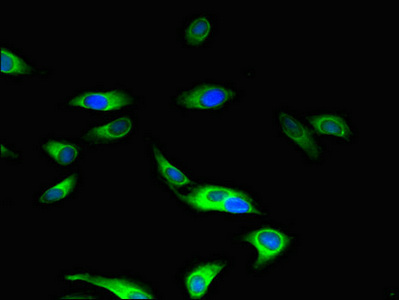 MAP3K5 / ASK1 Antibody - Immunofluorescent analysis of Hela cells using MAP3K5 Antibody at dilution of 1:100 and Alexa Fluor 488-congugated AffiniPure Goat Anti-Rabbit IgG(H+L)