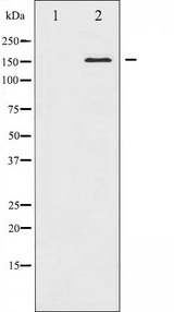 MAP3K5 / ASK1 Antibody - Western blot analysis of ASK1 expression in MDA-MB-435 whole cells lysates. The lane on the left is treated with the antigen-specific peptide.