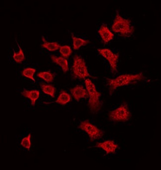MAP3K5 / ASK1 Antibody - Staining MDA-MB-435 cells by IF/ICC. The samples were fixed with PFA and permeabilized in 0.1% Triton X-100, then blocked in 10% serum for 45 min at 25°C. The primary antibody was diluted at 1:200 and incubated with the sample for 1 hour at 37°C. An Alexa Fluor 594 conjugated goat anti-rabbit IgG (H+L) Ab, diluted at 1/600, was used as the secondary antibody.