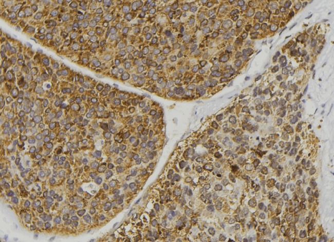 MAP3K5 / ASK1 Antibody - 1:100 staining human pancreas tissue by IHC-P. The sample was formaldehyde fixed and a heat mediated antigen retrieval step in citrate buffer was performed. The sample was then blocked and incubated with the antibody for 1.5 hours at 22°C. An HRP conjugated goat anti-rabbit antibody was used as the secondary.