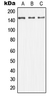 MAP3K5 / ASK1 Antibody - Western blot analysis of ASK1 expression in HeLa (A); SP2/0 (B); H9C2 (C) whole cell lysates.
