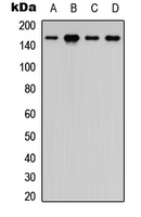 MAP3K5 / ASK1 Antibody - Western blot analysis of ASK1 (pS83) expression in K562 (A); HeLa (B); SP20 (C); PC12 (D) whole cell lysates.