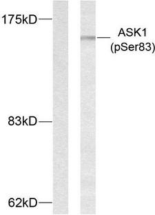 MAP3K5 / ASK1 Antibody - Western blot analysis of lysates from MDA-MB-435 cells treated with TNF-alpha, using ASK1 (Phospho-Ser83) Antibody. The lane on the left is blocked with the phospho peptide.