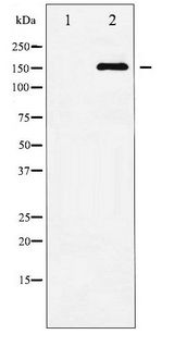 MAP3K5 / ASK1 Antibody - Western blot of ASK1 phosphorylation expression in TNF- alpha treated MDA-MB-435 whole cell lysates,The lane on the left is treated with the antigen-specific peptide.