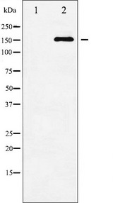 MAP3K5 / ASK1 Antibody - Western blot analysis of ASK1 phosphorylation expression in TNF-a treated MDA-MB-435 whole cells lysates. The lane on the left is treated with the antigen-specific peptide.