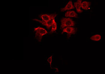 MAP3K5 / ASK1 Antibody - Staining MDA-MB-435 cells by IF/ICC. The samples were fixed with PFA and permeabilized in 0.1% Triton X-100, then blocked in 10% serum for 45 min at 25°C. The primary antibody was diluted at 1:200 and incubated with the sample for 1 hour at 37°C. An Alexa Fluor 594 conjugated goat anti-rabbit IgG (H+L) Ab, diluted at 1/600, was used as the secondary antibody.
