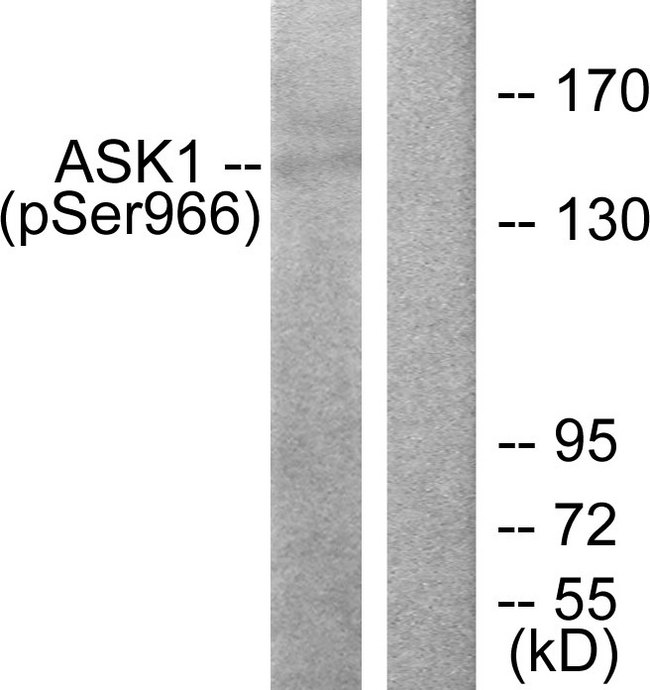 MAP3K5 / ASK1 Antibody - Western blot analysis of lysates from 293 cells treated with TNF(20ng/ml)+calyculinA(50nM) 15', using ASK1 (Phospho-Ser966) Antibody. The lane on the right is blocked with the phospho peptide.