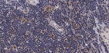 MAP3K5 / ASK1 Antibody - 1:100 staining human lymph node tissue by IHC-P. The tissue was formaldehyde fixed and a heat mediated antigen retrieval step in citrate buffer was performed. The tissue was then blocked and incubated with the antibody for 1.5 hours at 22°C. An HRP conjugated goat anti-rabbit antibody was used as the secondary.