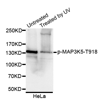 MAP3K5 / ASK1 Antibody - Western blot analysis of extracts of HeLa cells.