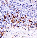 MAP3K6 / MEKK6 Antibody - Mouse Map3k6 Antibody immunohistochemistry of formalin-fixed and paraffin-embedded mouse stomach tissue followed by peroxidase-conjugated secondary antibody and DAB staining.