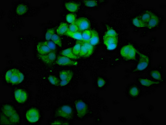 MAP3K6 / MEKK6 Antibody - Immunofluorescence staining of MCF-7 cells at a dilution of 1:100, counter-stained with DAPI. The cells were fixed in 4% formaldehyde, permeabilized using 0.2% Triton X-100 and blocked in 10% normal Goat Serum. The cells were then incubated with the antibody overnight at 4 °C.The secondary antibody was Alexa Fluor 488-congugated AffiniPure Goat Anti-Rabbit IgG (H+L) .