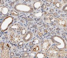 MAP3K6 / MEKK6 Antibody - 1:100 staining human kidney tissue by IHC-P. The tissue was formaldehyde fixed and a heat mediated antigen retrieval step in citrate buffer was performed. The tissue was then blocked and incubated with the antibody for 1.5 hours at 22°C. An HRP conjugated goat anti-rabbit antibody was used as the secondary.