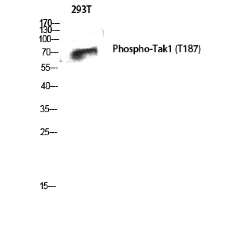 MAP3K7 / TAK1 Antibody - Western blot of Phospho-Tak1 (T187) antibody