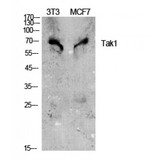 MAP3K7 / TAK1 Antibody - Western blot of Tak1 antibody