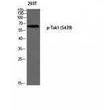 MAP3K7 / TAK1 Antibody - Western blot of Phospho-Tak1 (S439) antibody