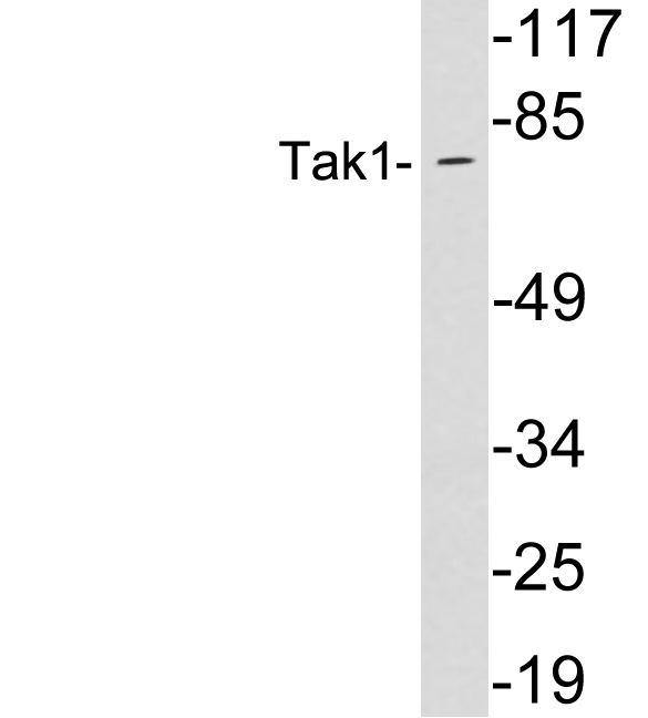 MAP3K7 / TAK1 Antibody - Western blot analysis of lysates from Jurkat cells, using Tak1 antibody.