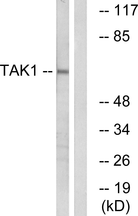 MAP3K7 / TAK1 Antibody - Western blot analysis of lysates from HepG2 cells, using TAK1 Antibody. The lane on the right is blocked with the synthesized peptide.