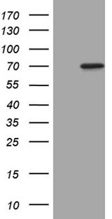 MAP3K7 / TAK1 Antibody - HEK293T cells were transfected with the pCMV6-ENTRY control. (Left lane) or pCMV6-ENTRY MAP3K7. (Right lane) cDNA for 48 hrs and lysed. Equivalent amounts of cell lysates. (5 ug per lane) were separated by SDS-PAGE and immunoblotted with anti-MAP3K7. (1:2000)