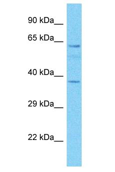 MAP3K7 / TAK1 Antibody - MAP3K7 / TAK1 antibody Western Blot of Fetal Kidney. Antibody dilution: 1 ug/ml.  This image was taken for the unconjugated form of this product. Other forms have not been tested.