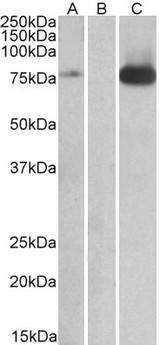 MAP3K7 / TAK1 Antibody - HEK293 lysate (10ug protein in RIPA buffer) overexpressing Human MAP3K7 with DYKDDDDK tag probed with (1ug/ml) in Lane A and probed with anti- DYKDDDDK Tag (1/3000) in lane C. Mock-transfected HEK293 probed (1mg/ml) in Lane B. Primary