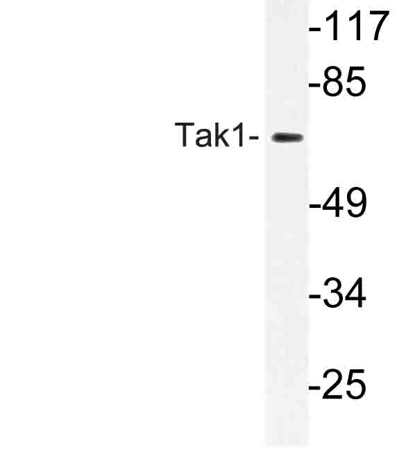 MAP3K7 / TAK1 Antibody - Western blot of Tak1 (D181) pAb in extracts from Jurkat cells.