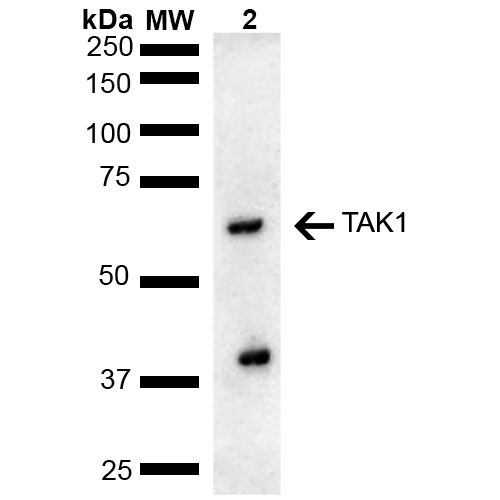 MAP3K7 / TAK1 Antibody - Western blot analysis of Rat liver lysate showing detection of ~67.2 kDa TAK1 protein using Rabbit Anti-TAK1 Polyclonal Antibody. Lane 1: Molecular Weight Ladder (MW). Lane 2: Rat liver lysate. Load: 15 µg. Block: 5% Skim Milk in 1X TBST. Primary Antibody: Rabbit Anti-TAK1 Polyclonal Antibody  at 1:1000 for 2 hours at RT. Secondary Antibody: Goat Anti-Rabbit HRP:IgG at 1:4000 for 1 hour at RT. Color Development: ECL solution for 5 min at RT. Predicted/Observed Size: ~67.2 kDa. Other Band(s): ~40 kDa potential degradation product.