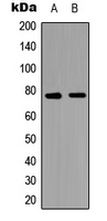 MAP3K7 / TAK1 Antibody - Western blot analysis of TAK1 expression in PC3 (A); NIH3T3 (B) whole cell lysates.