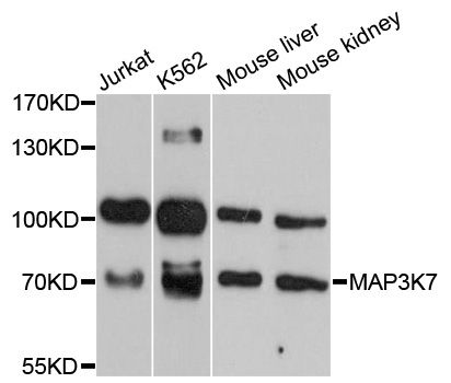 MAP3K7 / TAK1 Antibody - Western blot analysis of extracts of various cell lines, using MAP3K7 antibody at 1:3000 dilution. The secondary antibody used was an HRP Goat Anti-Rabbit IgG (H+L) at 1:10000 dilution. Lysates were loaded 25ug per lane and 3% nonfat dry milk in TBST was used for blocking. An ECL Kit was used for detection and the exposure time was 60s.