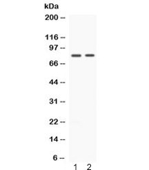 MAP3K7 / TAK1 Antibody - Western blot testing of 1) rat spleen and 2) human HeLa lysate with TAK1 antibody at 0.5ug/ml. Predicted molecular weight: 64-69 kDa, observed here at ~79 kDa.