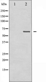 MAP3K7 / TAK1 Antibody - Western blot analysis of MAP3K7 expression in Jurkat whole cells lysates. The lane on the left is treated with the antigen-specific peptide.