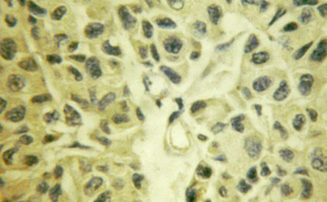 MAP3K7 / TAK1 Antibody - 1/100 staining human liver tissue by IHC-P. The sample was formaldehyde fixed and a heat mediated antigen retrieval step in citrate buffer was performed. The sample was then blocked and incubated with the antibody for 1.5 hours at 22°C. An HRP conjugated goat anti-rabbit antibody was used as the secondary antibody.