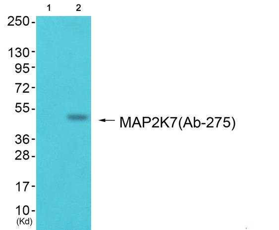 MAP3K7 / TAK1 Antibody - Western blot analysis of extracts from A549 cells and JurKat cells, using MAP2K7 (Ab-275) antibody.