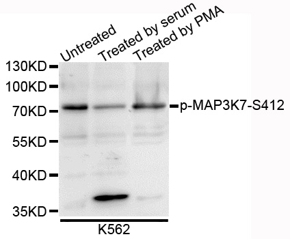 MAP3K7 / TAK1 Antibody - Western blot analysis of extracts of K562 cells.