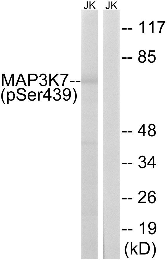 MAP3K7 / TAK1 Antibody - Western blot analysis of lysates from Jurkat cells treated with PMA 125ng/ml 30', using MAP3K7 (Phospho-Ser439) Antibody. The lane on the right is blocked with the phospho peptide.