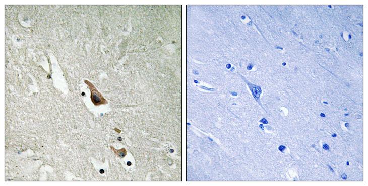 MAP3K7 / TAK1 Antibody - P-peptide - + Immunohistochemistry analysis of paraffin-embedded human brain tissue using MAP3K7 (Phospho-Ser439) antibody.
