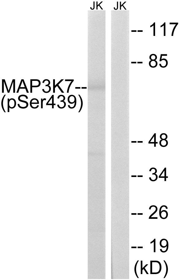 MAP3K7 / TAK1 Antibody - Western blot analysis of extracts from Jurkat cells, treated with PMA (125ng/ml, 30mins), using MAP3K7 (Phospho-Ser439) antibody.