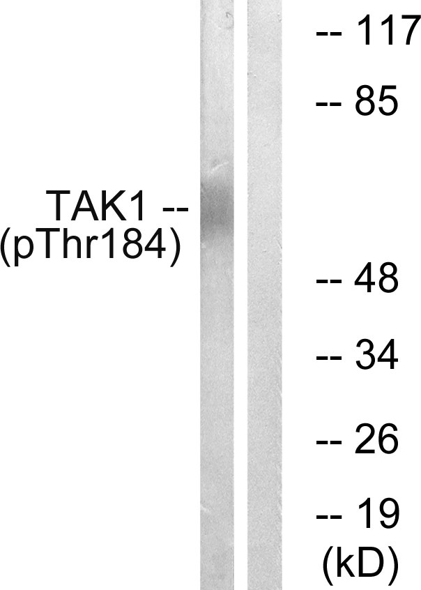 MAP3K7 / TAK1 Antibody - Western blot analysis of lysates from HepG2 cells treated with TNF 20ng/ml 5', using TAK1 (Phospho-Thr184) Antibody. The lane on the right is blocked with the phospho peptide.
