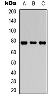 MAP3K7 / TAK1 Antibody - Western blot analysis of TAK1 (pT187) expression in A431 (A); HeLa (B); mouse liver (C) whole cell lysates.