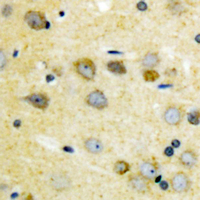MAP3K7 / TAK1 Antibody - Immunohistochemical analysis of TAK1 (pT187) staining in human brain formalin fixed paraffin embedded tissue section. The section was pre-treated using heat mediated antigen retrieval with sodium citrate buffer (pH 6.0). The section was then incubated with the antibody at room temperature and detected using an HRP conjugated compact polymer system. DAB was used as the chromogen. The section was then counterstained with hematoxylin and mounted with DPX.